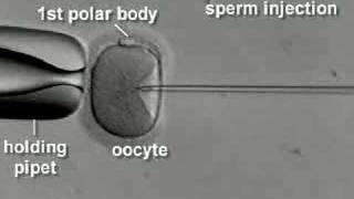 IVF amp ICSI brief overview [upl. by Naji]