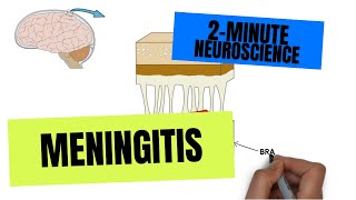 2Minute Neuroscience Meningitis [upl. by Ylsew]