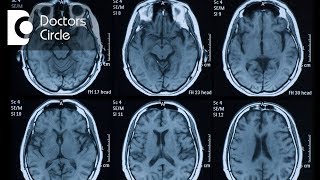 Resting tremor of Parkinson Disease [upl. by Krenek609]