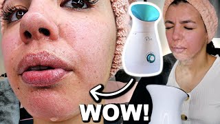 I Tested The Best FACIAL STEAMER On Amazon [upl. by Llerrom]