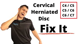 Disc Herniation vs Disc Bulge [upl. by Beatrisa]