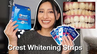 I TRIED THE CREST 3D WHITESTRIPS FOR 14 DAYS Effective  Before amp After pictures [upl. by Edniya350]