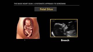 Understanding Fetal Circulation [upl. by Aramak]