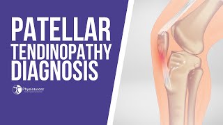 How to Diagnose Patellar Tendinopathy  Jumpers Knee Diagnosis [upl. by Akihsan]