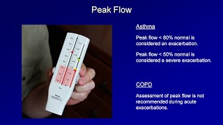 Acute Asthma Exacerbation  USMLE Pulmonology  BoardsMD [upl. by Tram]