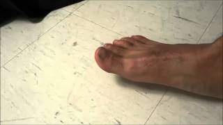 How To Crack Your ToesRelieving Toe Pain [upl. by Hawker]