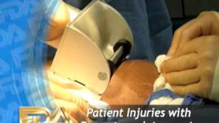 Avoiding Patient Injuries with Dermatome Instruments [upl. by Repohtsirhc405]