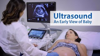 ULTRASOUND An Early View of Baby [upl. by Flosser]