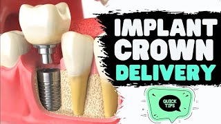 Implant Crown Delivery TIPS  Screw Retained Implant Crowns [upl. by Areip]