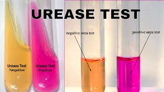 Urea Hydrolysis Urease Test [upl. by Lek283]