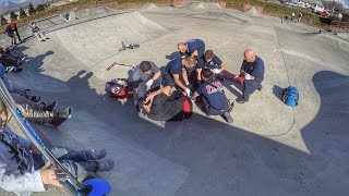 DAD BREAKS HIS LEG IN TWO PLACES AT SKATE PARK WITH FOUR KIDS [upl. by Eimac]