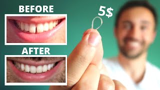 DIY CLOSE GAP TEETH AT HOME  My Update [upl. by Aihsekram]