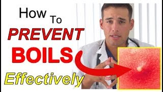 How to PREVENT Boils Effectively 4 STEPS  The Best Way to PREVENT Boils From Coming Back [upl. by Cathi]