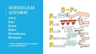 Neurovascular Assessment [upl. by Emmeram751]