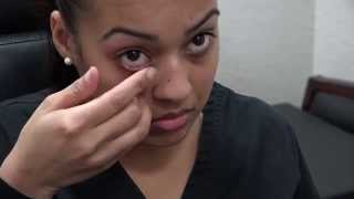 How to Apply Ointment to the Eyes and Eyelids [upl. by Suanne]