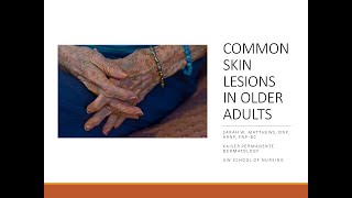 Common Skin Lesions in Older Adults [upl. by Lenox256]