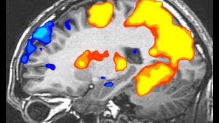 fMRI BrainScan SideView [upl. by Ecirtram3]