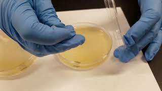 Oxidase Test [upl. by Fulmer]