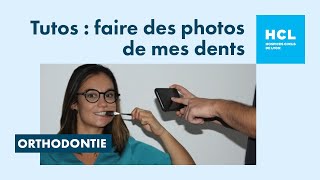 Comment faire des photos pour lorthodontiste  Urgence orthodontie [upl. by Dyraj]