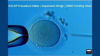 ICSI IVF Procedure Video  Important things  RSMC Fertility Clinic [upl. by Yunfei]