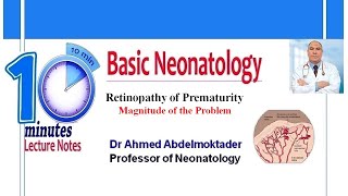 Retinopathy Of Prematurity [upl. by Blaze]