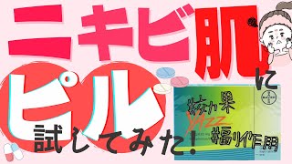 【副作用あり】ピルでニキビ肌は変わる太る効果や値段、デメリットを紹介7年ヤーズを服用しました！ [upl. by Coppola429]