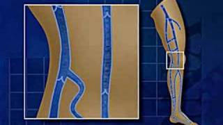 Mechanisms of Venous Return Animation [upl. by Ynar389]