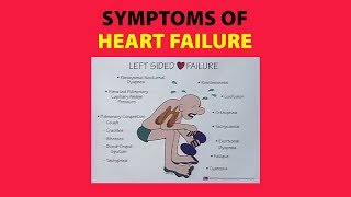 Symptoms of Heart Failure [upl. by Sukram]