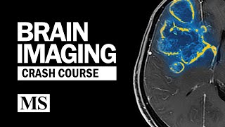 Brain Imaging Crash Course [upl. by Nisbet]