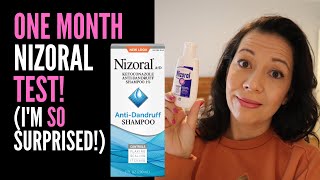 HAIR LOSS SUFFERER REVIEWS NIZORAL SHAMPOO One Month Review On 2 Ketoconazole IM VERY SURPRISED [upl. by Ijies38]