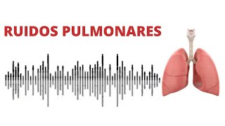 Patrones Pulmonares en Radiología y TC [upl. by Ahsem]