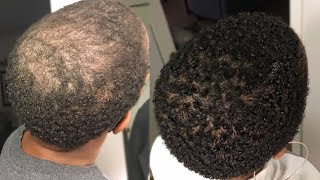 My 100 Natural HAIR GROWTH Serum  2 Month Update  GrowWithMe  Nia Hope [upl. by Eyeleen]