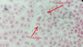 Study of Mitosis using onion root tips  squash preparation  stages of mitosis [upl. by Ahseila]