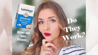 Lumineux Whitening Strips  Honest Review [upl. by Dunc]