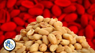 The Truth About Peanut Allergies [upl. by Horwitz]