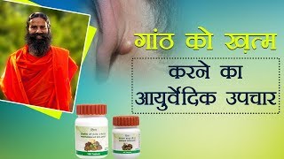 Ayurvedic Treatment for Lipoma गांठ  Swami Ramdev [upl. by Il]