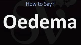 How to Pronounce Oedema CORRECTLY [upl. by Novy]