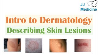 Introduction to Dermatology  The Basics  Describing Skin Lesions Primary amp Secondary Morphology [upl. by Meagan]