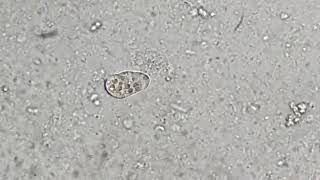 Trophozoite of Entamoeba histolytica [upl. by Hahsia]