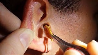 Technique japonaise pour déboucher les oreilles 3 ASMR [upl. by Htes]