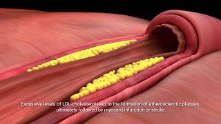 Lactobacillus plantarum INDUCIA [upl. by Naujek]