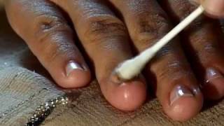 How to Cure Nail Fungus [upl. by Ahsiekel993]