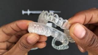 How to use Tooth Whitening Trays [upl. by Edmon]