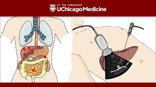 Introduction to Neoplasia Part 1 [upl. by Silsby]