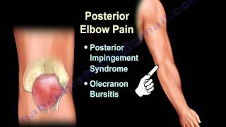 ELBOW PAIN  COMMON CAUSES  Everything You Need To Know  Dr Nabil Ebraheim [upl. by Dorr]