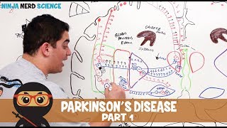 Parkinsons Disease  Clinical Presentation  Part 1 [upl. by Hoffmann827]