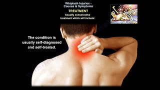 Whiplash Injuries Causes amp Symptoms  Everything You Need To Know  Dr Nabil Ebraheim [upl. by Nakre656]