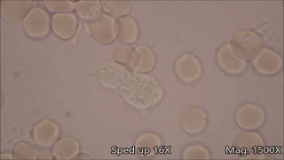 White Blood Cells under the Microscope [upl. by Nitsuj658]