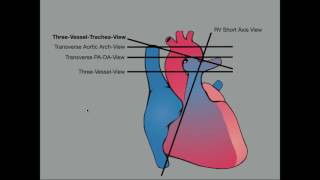 Advanced Evaluation of the Fetal Heart [upl. by Bethany338]