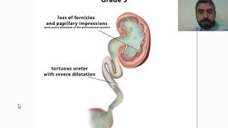 Stomach Ulcer  Nucleus Health [upl. by Rukna]